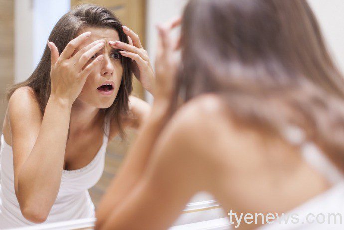 亂擠痘痘很危險!觸碰臉部「危險三角區」可能引發腦膜炎 10979179擠痘痘