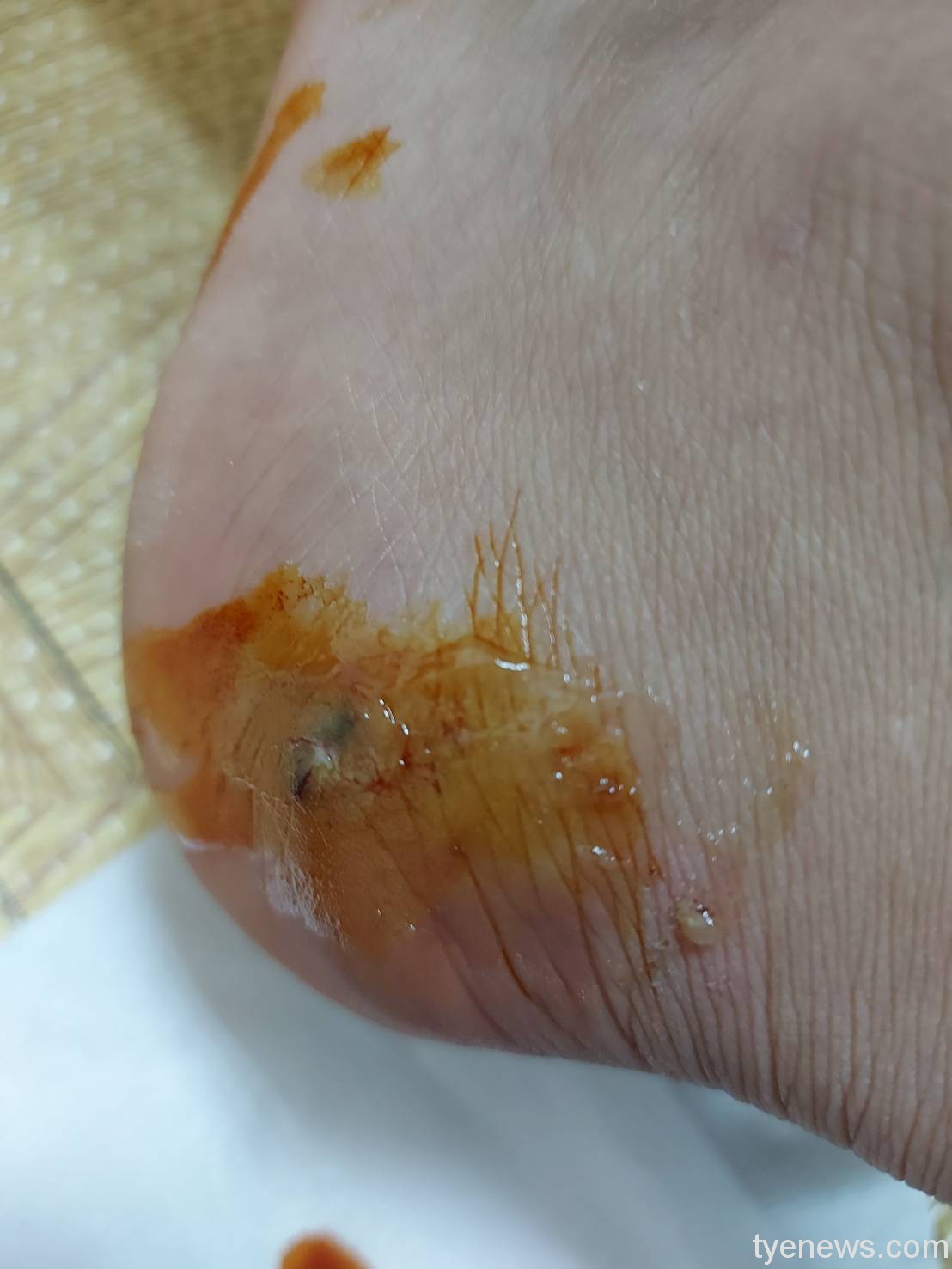 【有片】台電員工被黑狗撲咬 怒持棍棒回擊遭疑虐狗 206744