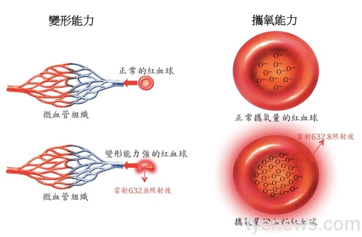 樂生「靜脈雷射能量」無感復健治療中風及腦傷患者 253