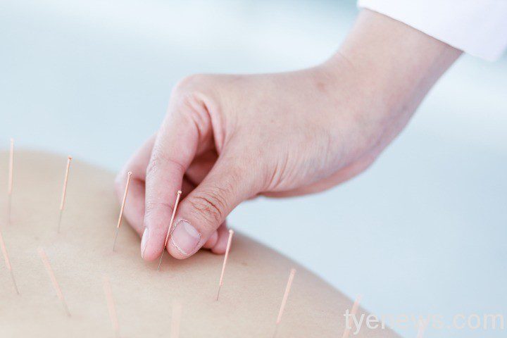 6840828針灸 6840828針灸