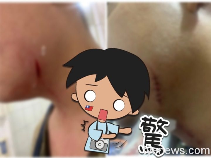 男友遭表妹爆打流血縫5針 母顧慮親戚要求息事寧人 85632