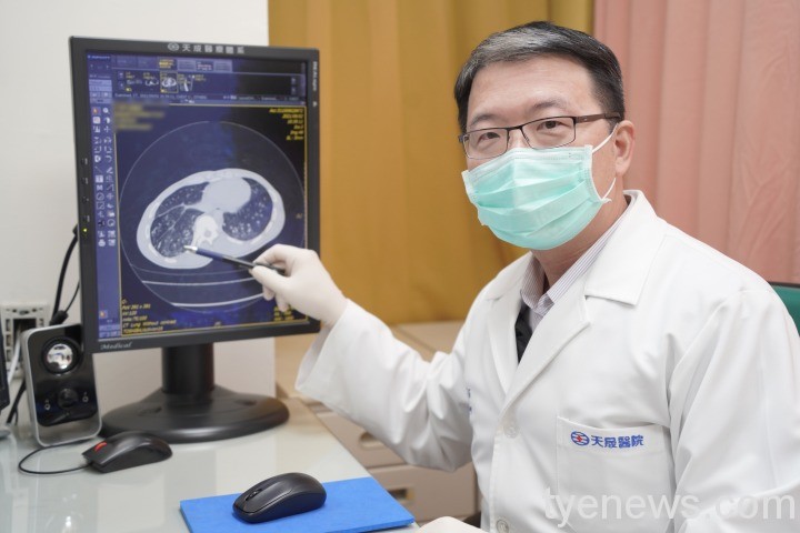 運動健將日日抽電子煙 狂咳、呼吸困難「嚴重肺損傷」 DSC4803