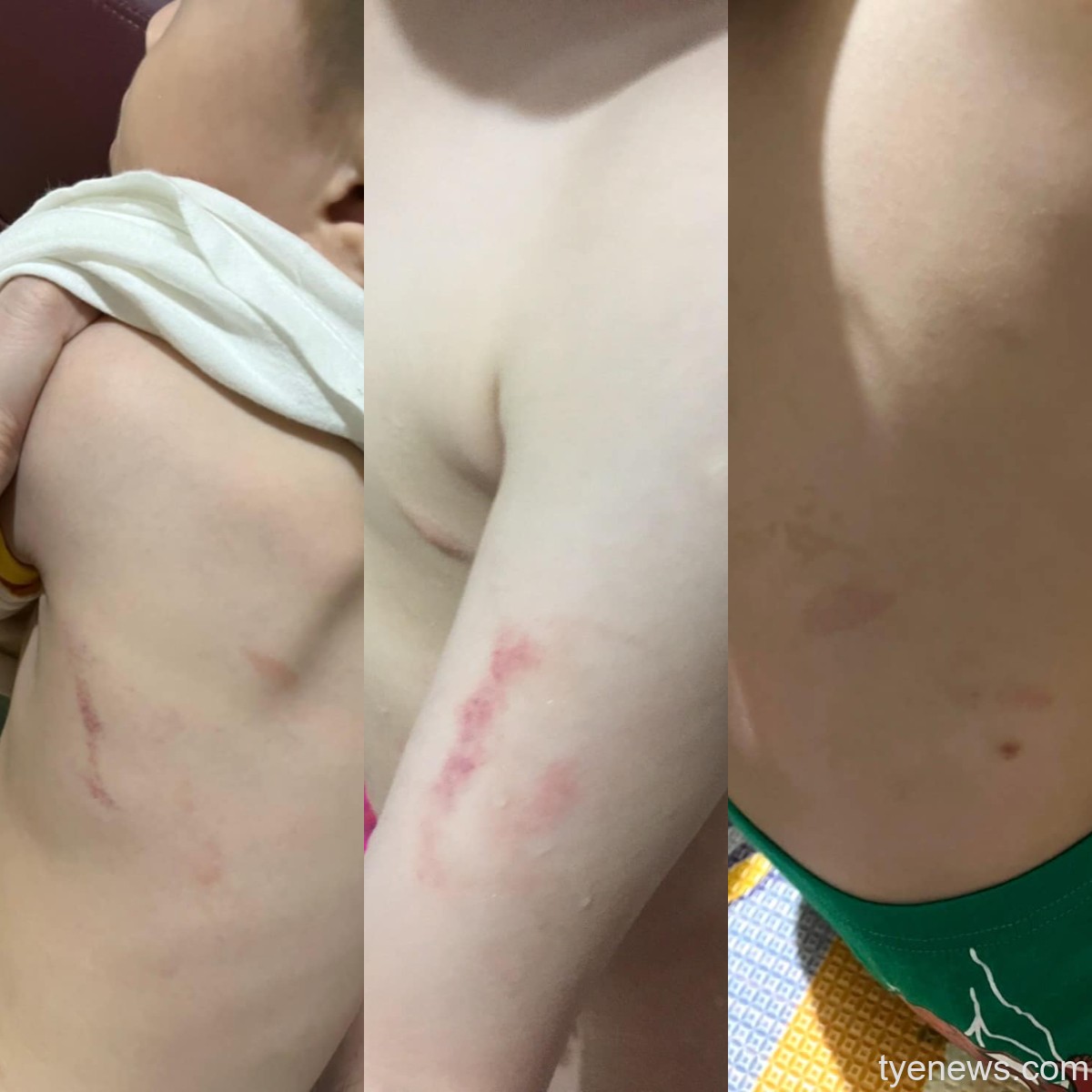 心疼!龍潭區某幼兒園驚爆無照師虐童 賴香伶率受害家屬提6訴求 FotoJet 12