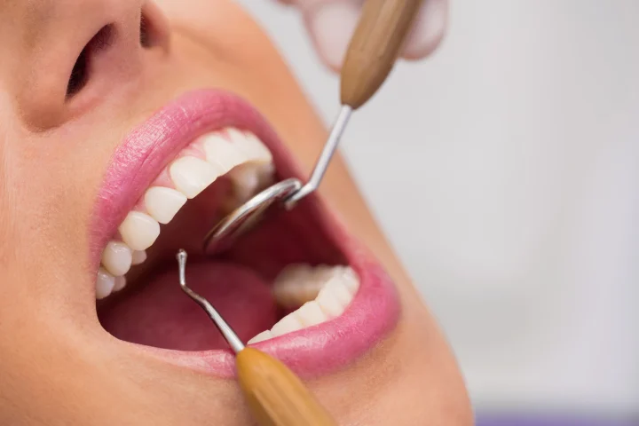 過年牙痛怎麼辦?連假牙醫急診這裡查 dentist examining female patient teeth 107420 65309 scaled 1