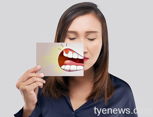 台灣平均每天23人被診斷患口腔癌 把握3原則守護健康 口腔癌13506315 1