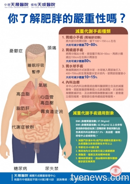 肥胖是慢性疾病 應飲食控制、規律運動 圖1 scaled 2