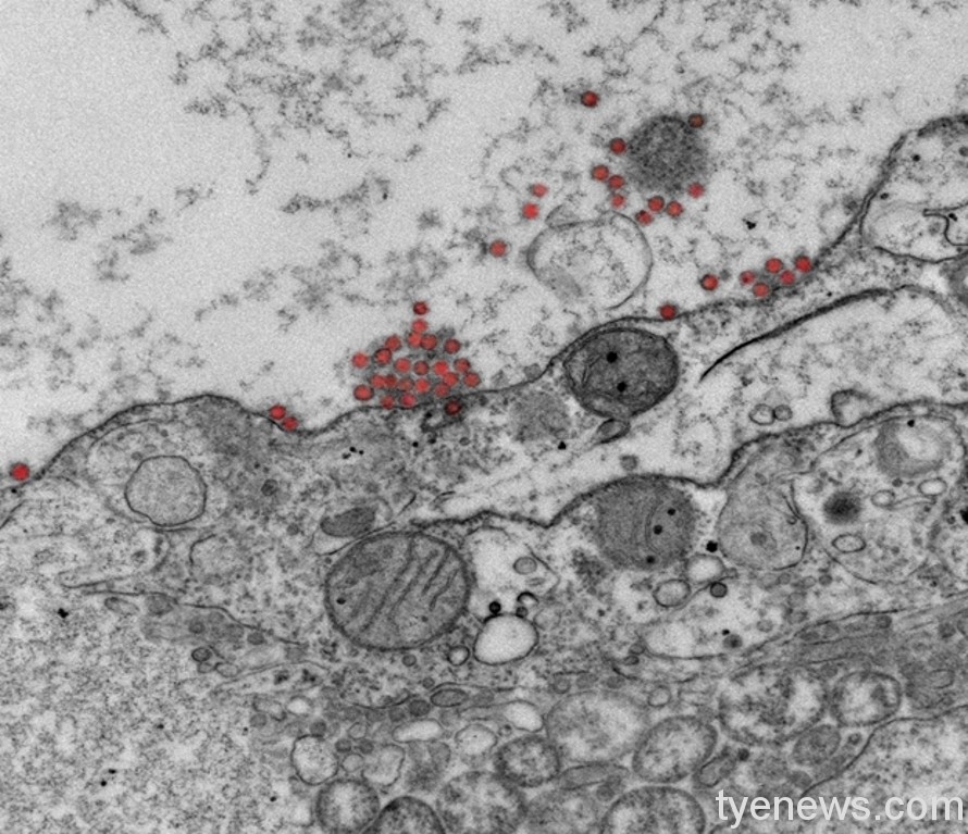長庚大學、國防醫學院合作研發「紫蘇水萃」抗新冠機能食品 圖3 3