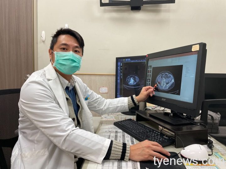 超高齡病患血便三個月 3D腹腔鏡手術切除癌細胞 媒體 1 2