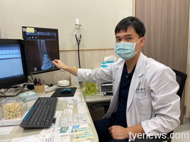 女病患10年腳踝扭傷致跛腳 人工踝關節置換手術5天改善 媒體 1 5