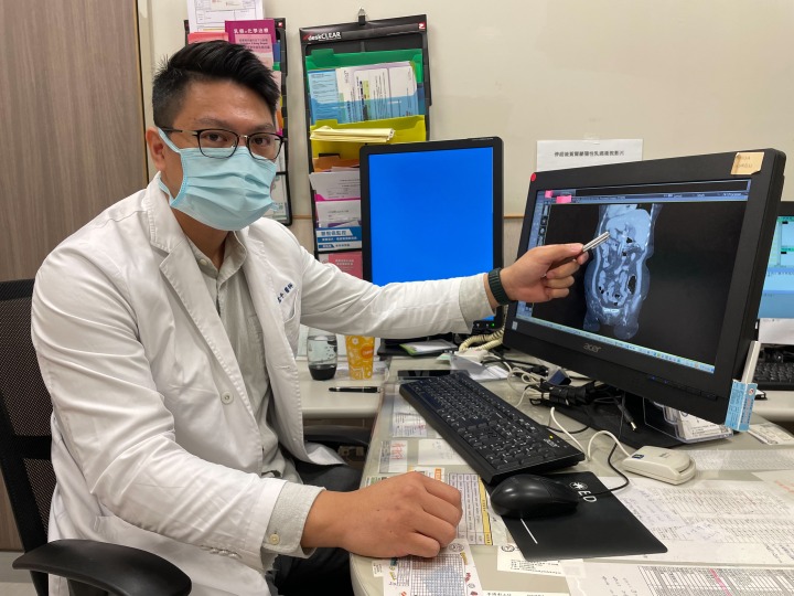 80歲嬤患急性膽囊炎 就醫發現內臟顛倒增加手術挑戰 媒體