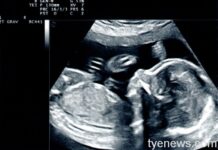 國一妹寒假與3男發生性關係 PO超音波照吵要生