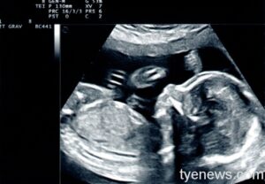 國一妹寒假與3男發生性關係 PO超音波照吵要生