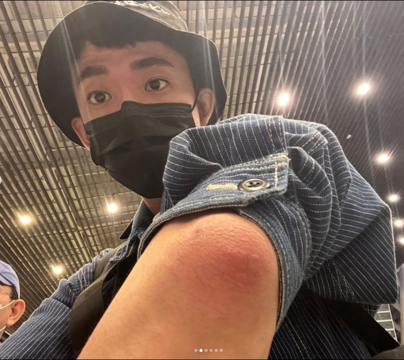阿滴驚傳「手肘變形」急就醫!罹患「這種病」粉絲全嚇壞 28343fbb 5576 4722 9f72 4c621d4f89d3