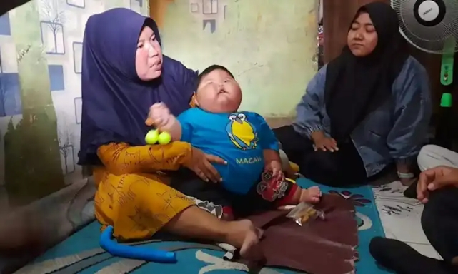 印尼巨嬰16個月27公斤!母笑:尿布穿「3XL」