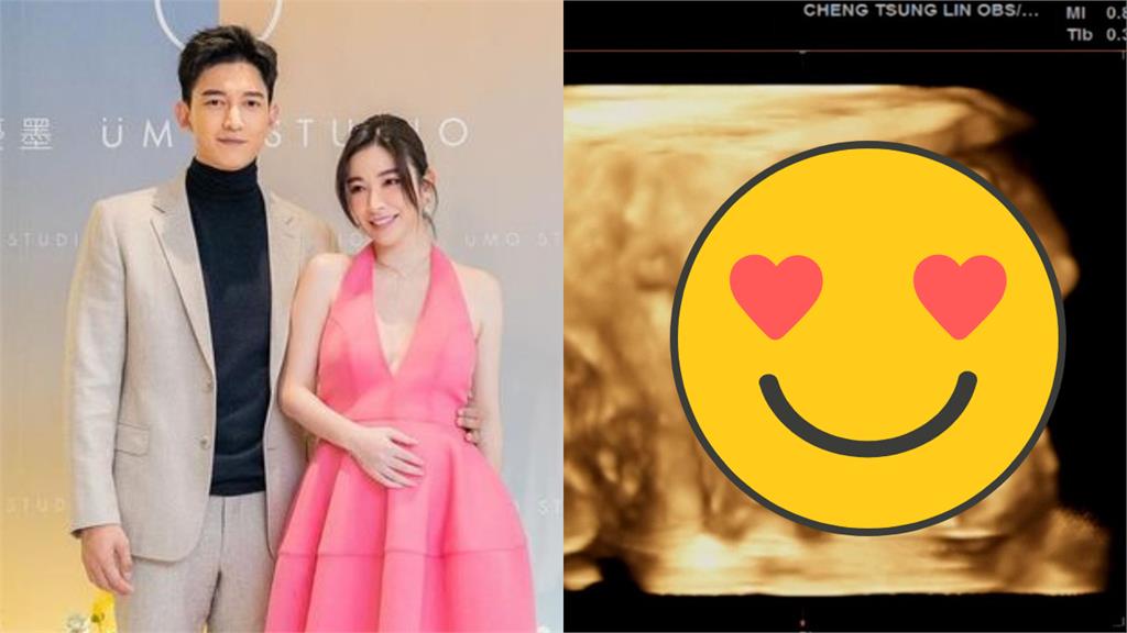 許維恩女兒「握拳如舉啞鈴」超萌!王家梁吐「新手爸最大恐慌」網笑翻