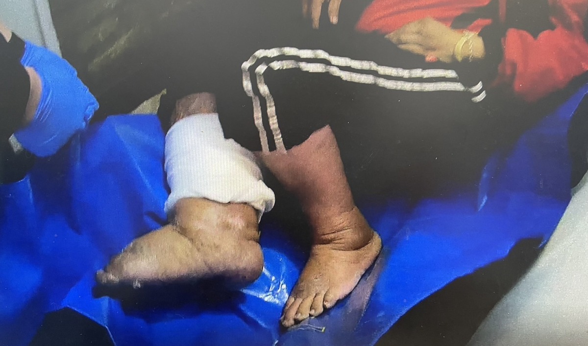 受困樓梯半天!5旬婦腿腫痛無法返家 中壢警消合力抬上樓 S 216096776