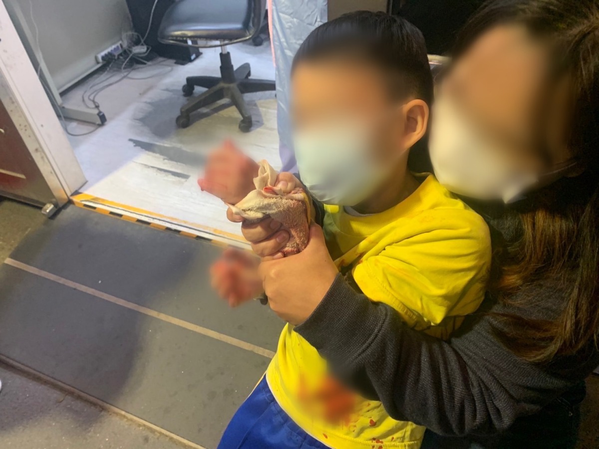 6歲童玩耍濺血 龜山警開道5分鐘送醫 S 47390733