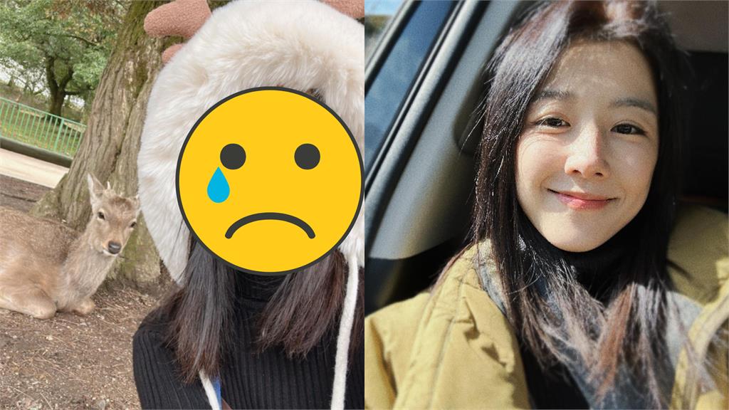 邵雨薇被奈良鹿咬了!她曬「奧嘟嘟氣臉」討拍