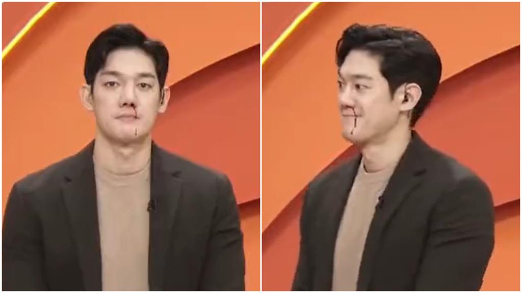 韓星節目中突噴鼻血!一轉身「流到下巴」全場嚇傻