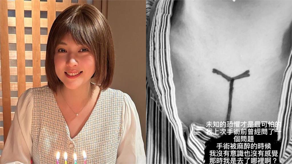 朱芯儀曬黑白照 曝抗癌心聲:未知恐懼最可怕