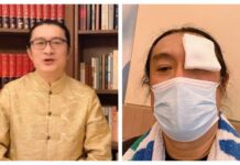 黃安動手術半瞎!曝光近況嘆氣了:一大堆計畫停擺