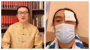 黃安動手術半瞎！曝光近況嘆氣了：一大堆計畫停擺