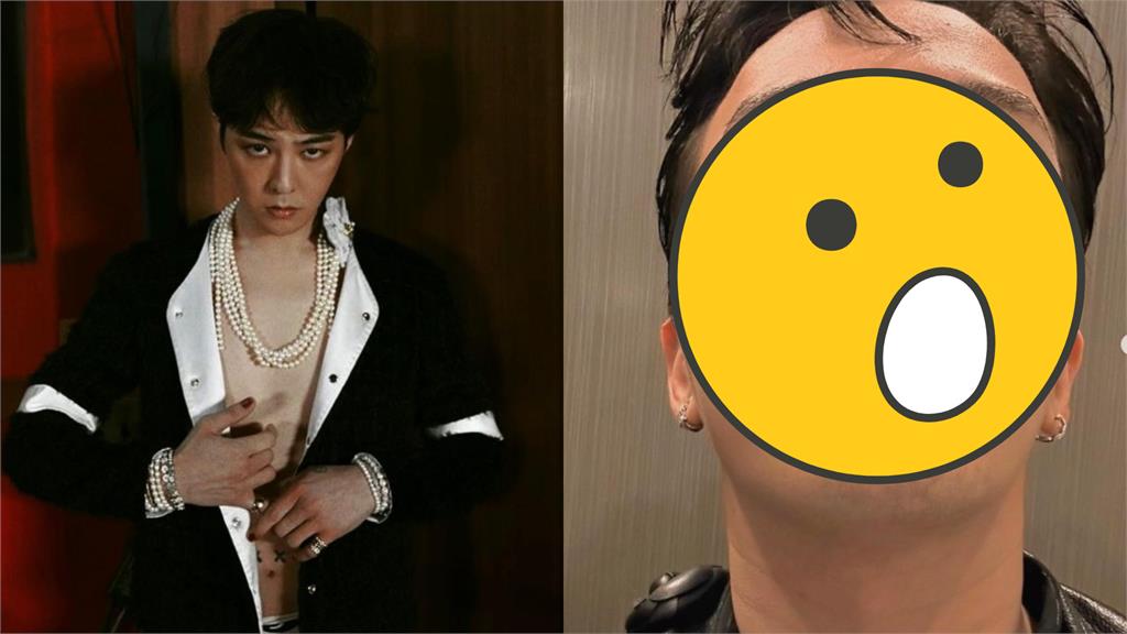 GD真面目流出!34歲膚況「滿臉痘痘」震撼網