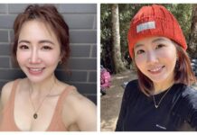 自曝「整型失敗」臉腫成豬頭!謝忻嘆後遺症超頭痛