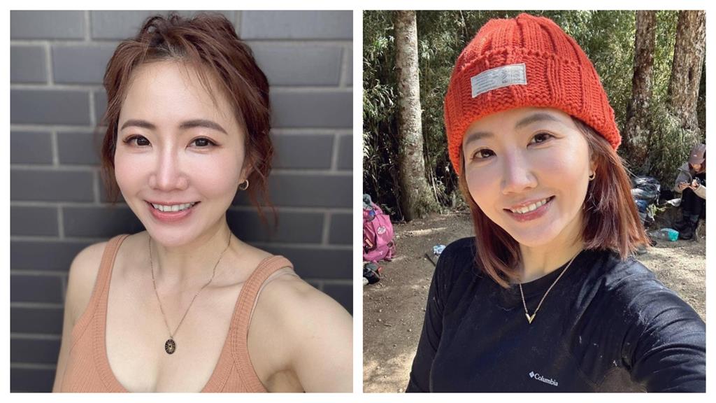 自曝「整型失敗」臉腫成豬頭!謝忻嘆後遺症超頭痛