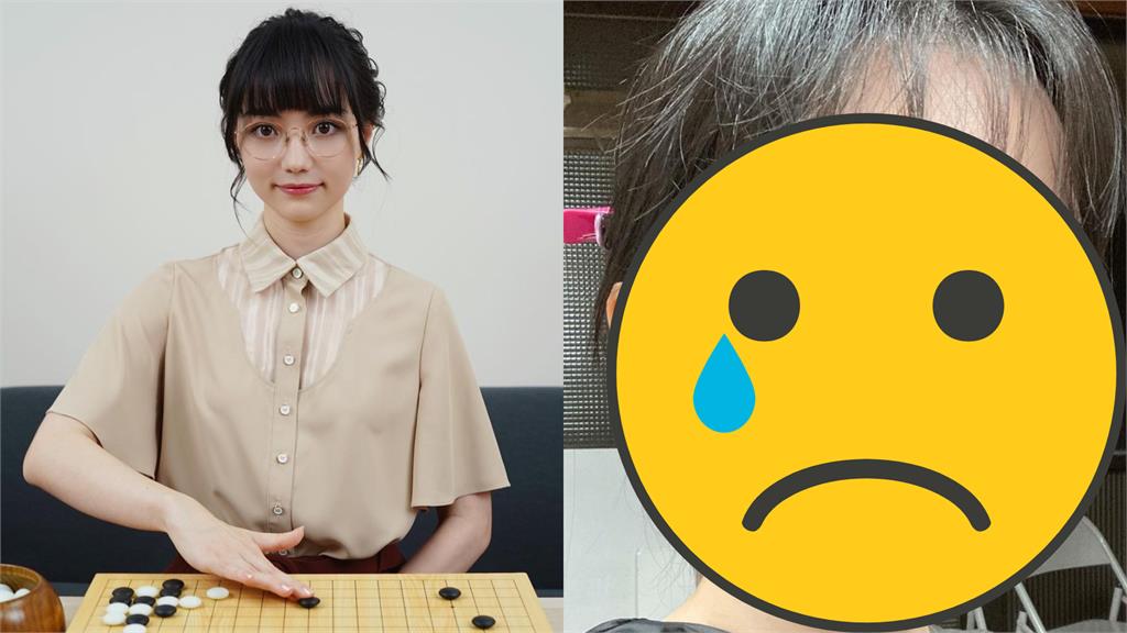 黑嘉嘉出事了?甜美臉蛋突冒大疙瘩萬網急關切