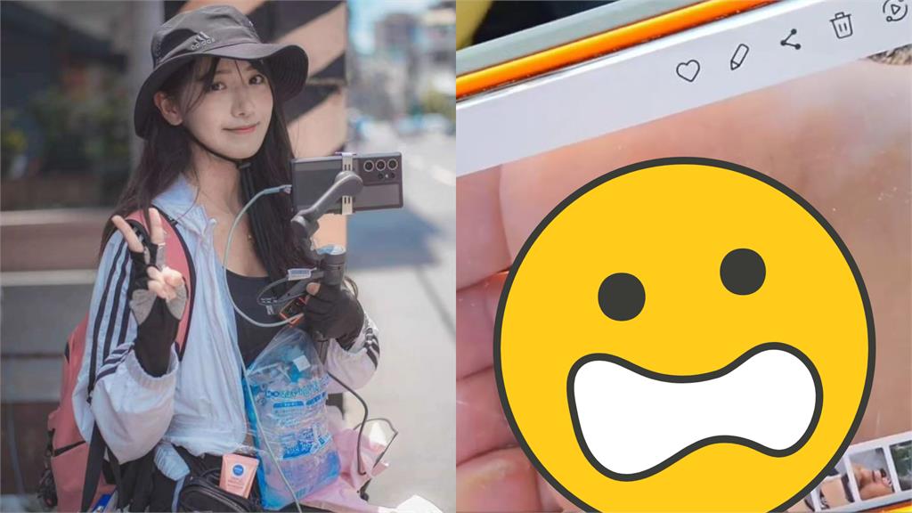 企鵝妹嫩足驚現「水泡天坑」!網心疼:感覺腳要爛掉