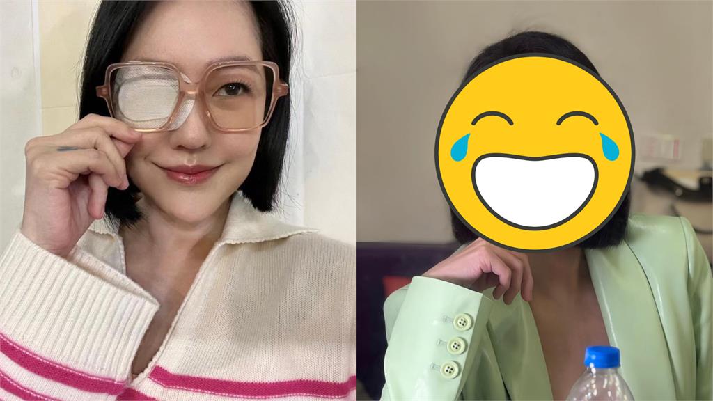 小S眼睛受傷變獨眼龍!宅魂爆發網笑:0違和