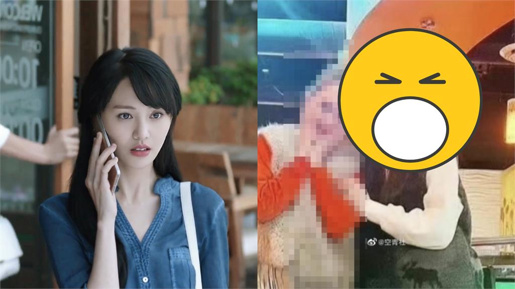 曾微微一笑很傾城!鄭爽「禿額又腫成包子」網嚇壞