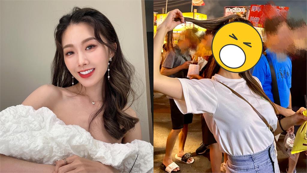 「廟會女神」罹罕見疾病!腫成月亮臉她淚求1件事