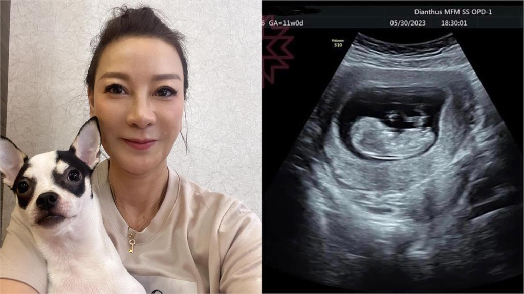58歲楊繡惠曬超音波照!嗨喊「滿3個月再公開」