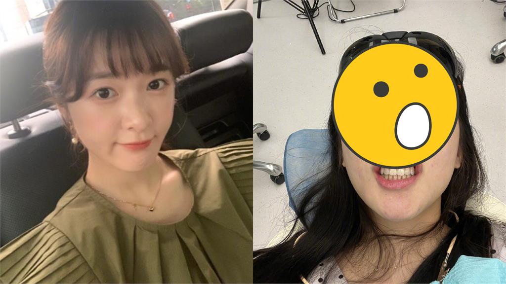 徐嬌無濾鏡生圖流出!真面目見「天坑毛孔」網嚇歪