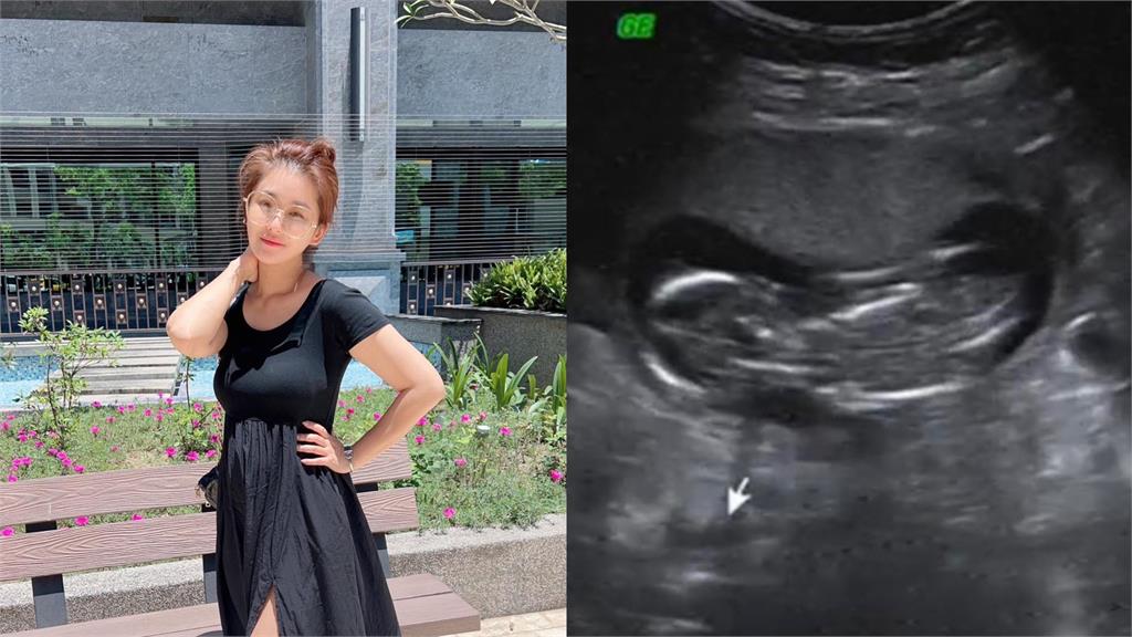 葉家妤停經「以為更年期」 懷第3寶她驚呼1句