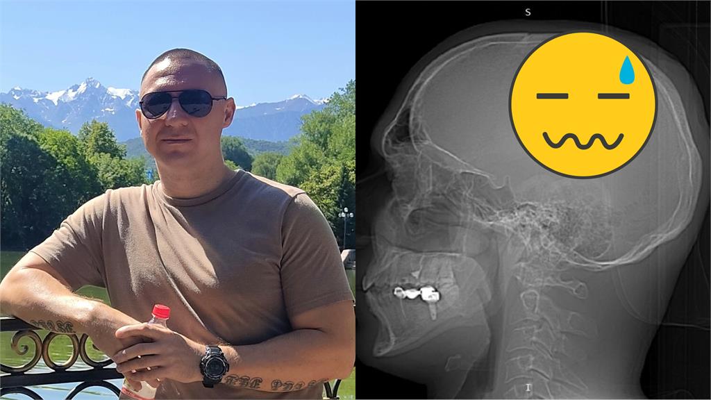 硬要當造夢者!他「0知識」將晶片植入大腦下場曝光