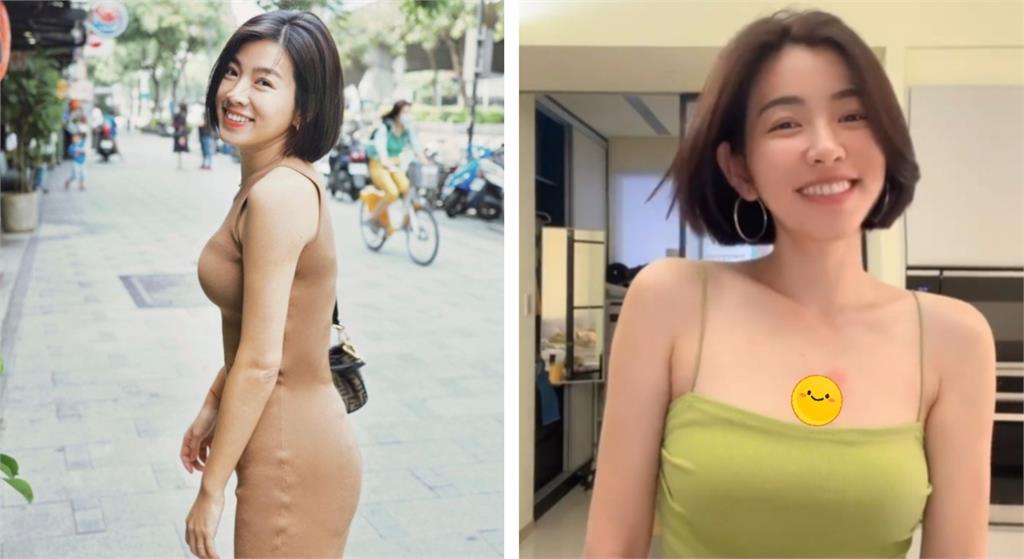 米可白胸口驚見「神秘紅腫」好害羞!本人解答了