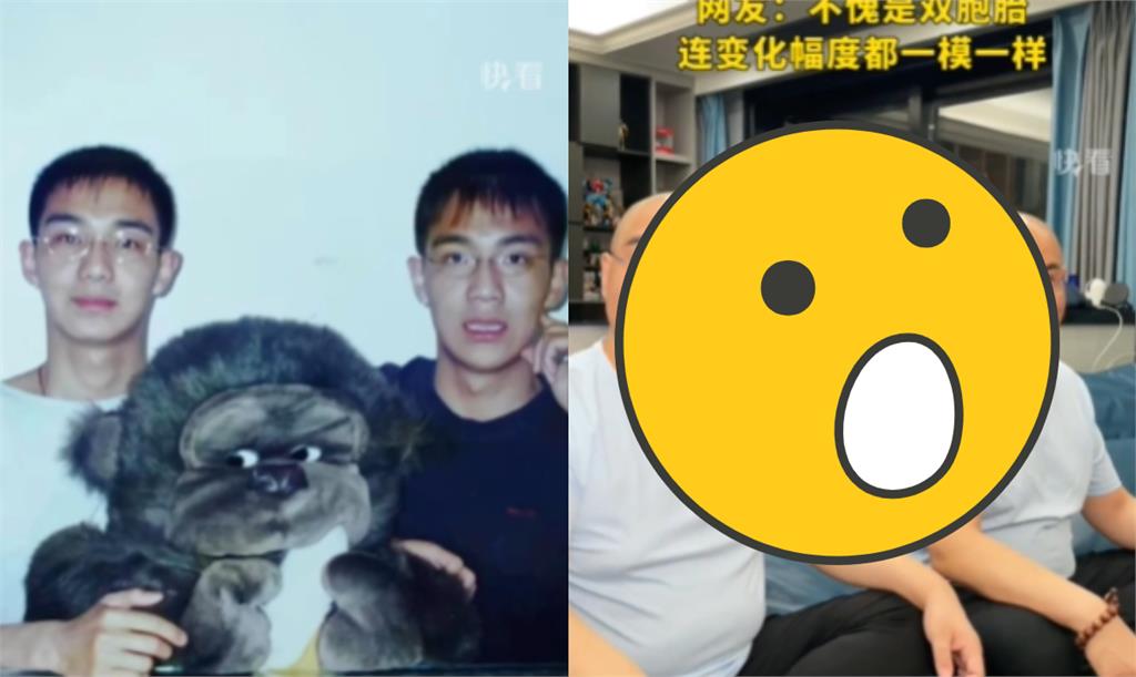 清秀少年變禿頭大叔…雙胞胎婚後「判若4人」網看傻