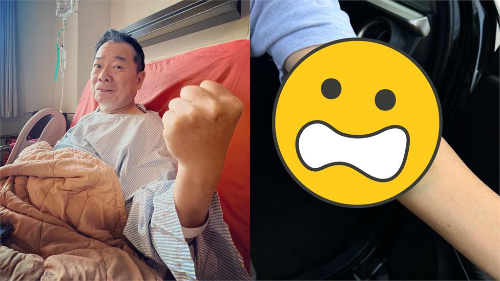 廖峻直奔律師事務所 手臂「整片瘀青」現況曝光