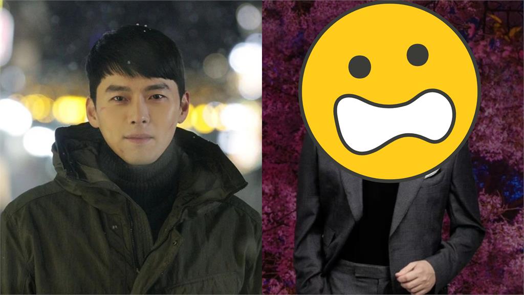 玄彬「整形失敗」震撼外流!雙眼變形網嚇:這誰?