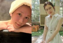 鄭家純揭寫真拍完「就動胸部手術」!1句曝原因