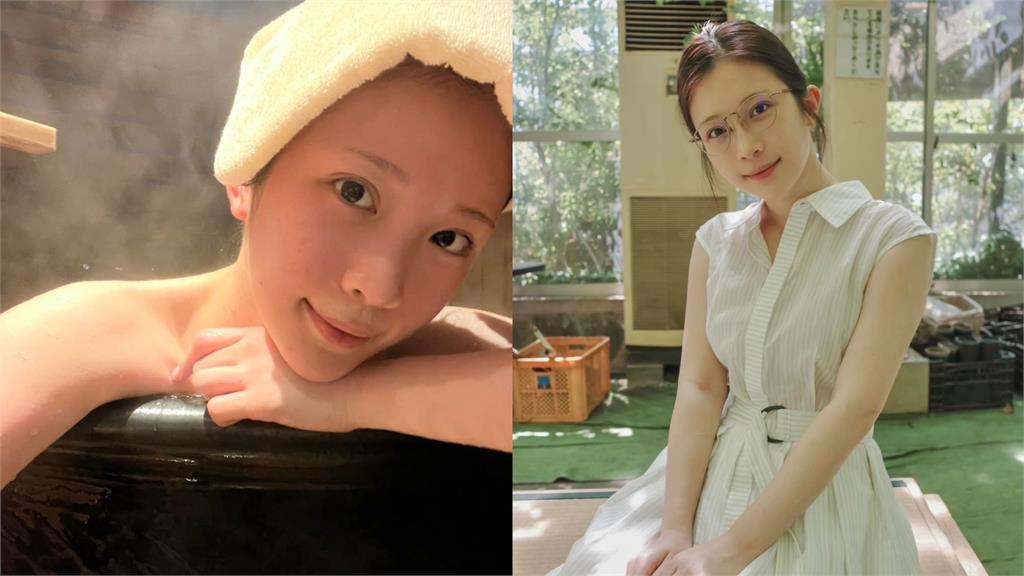 鄭家純揭寫真拍完「就動胸部手術」!1句曝原因