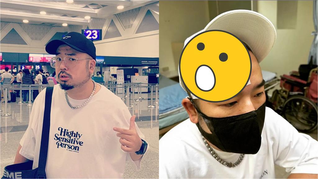 阿達皮蛇「爬滿額頭」險釀失明 他嘆:生不如死