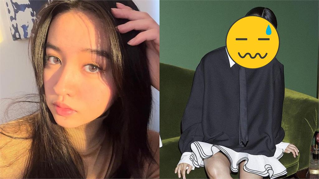 木村光希「臉中央穿3環」!美臉崩壞萬粉看傻了