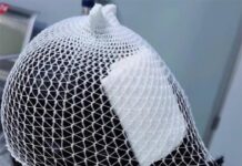 13歲少女浴室滑倒!「鯊魚夾」當場劃破她頭皮