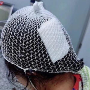 13歲少女浴室滑倒！「鯊魚夾」當場劃破她頭皮