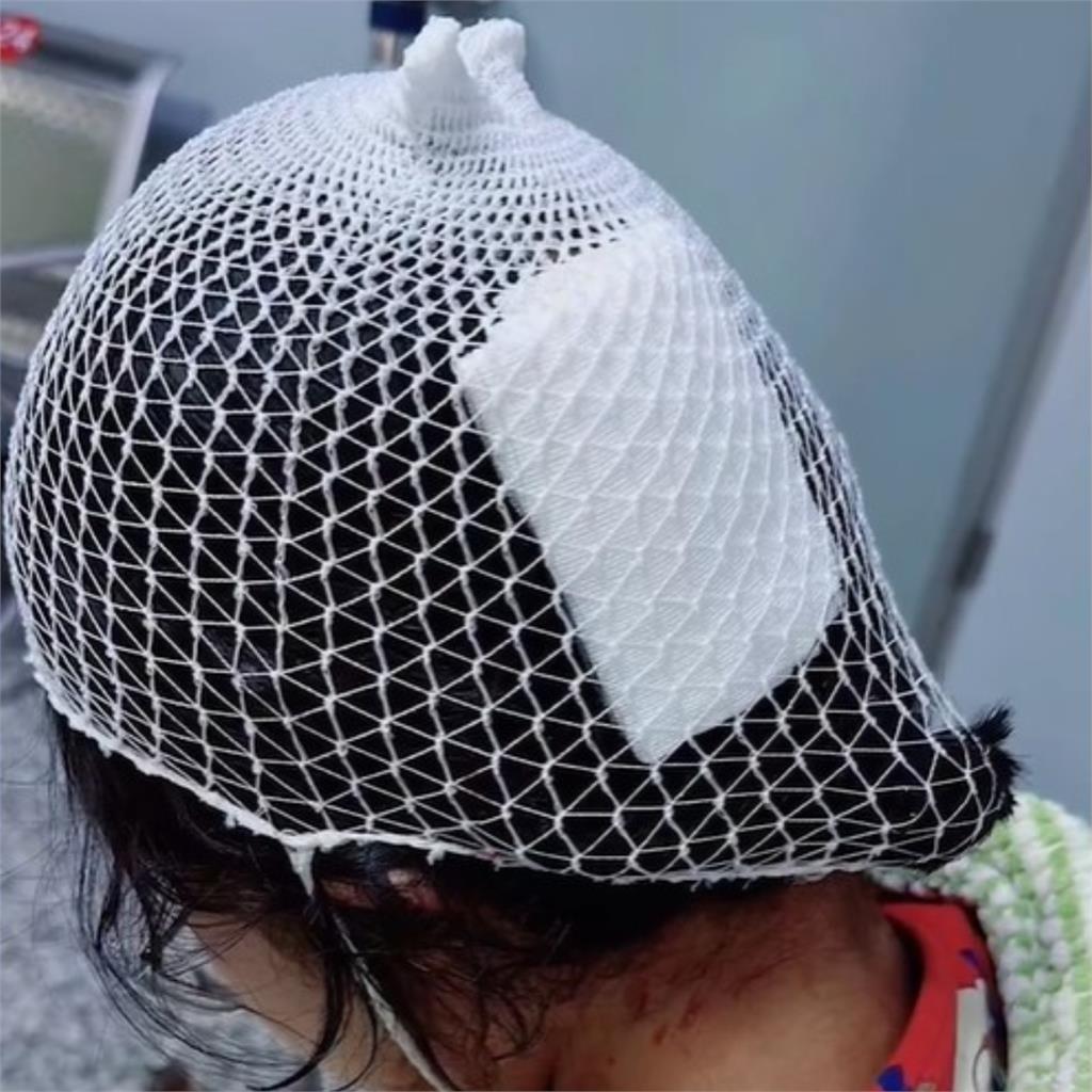 13歲少女浴室滑倒!「鯊魚夾」當場劃破她頭皮