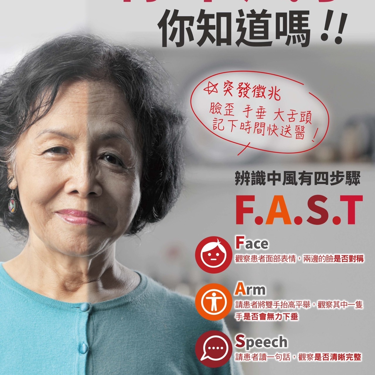 了解中風突發徵兆!出現三狀況記下時間快送醫 S 6562003